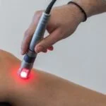 Skuteczne metody na problem z naczynkami – odkryj zalety laserowego zamykania naczynek